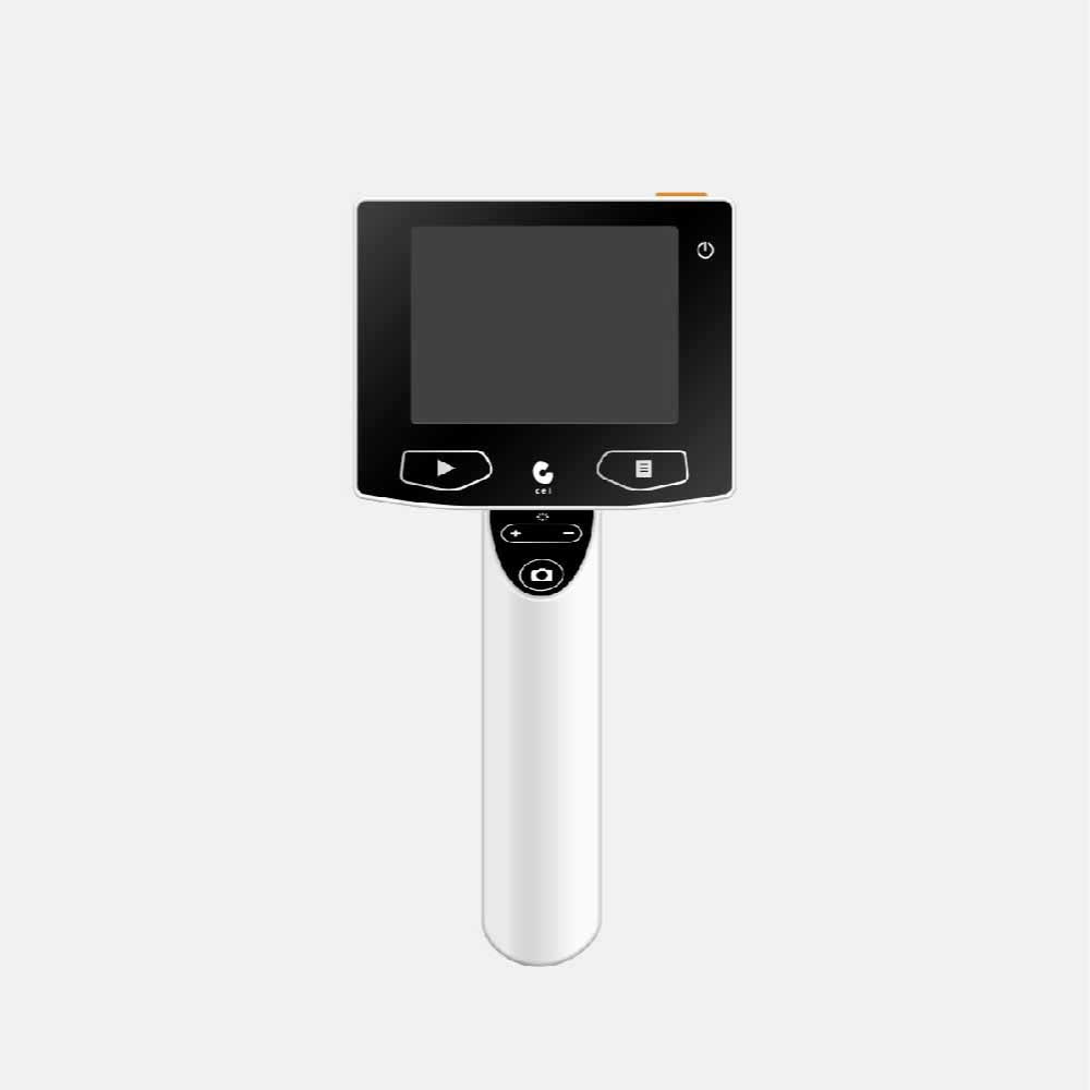 Digital Otoscope with Camera